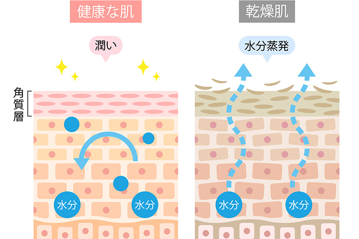 バリア機能が正常に働いている肌とバリアが乱れた肌の仕組み