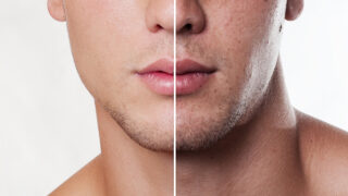 ヒゲ脱毛は何回で終わる?経験者が語る目安と受ける前に知っておきたい5つのこと