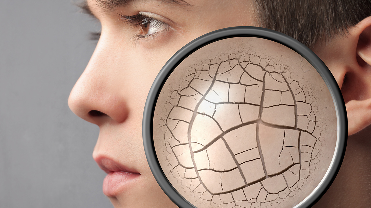 プロが教える乾燥肌の原因と効果的な対策方法